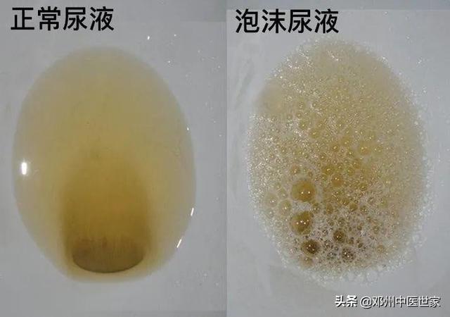 女童尿路感染 養(yǎng)狗