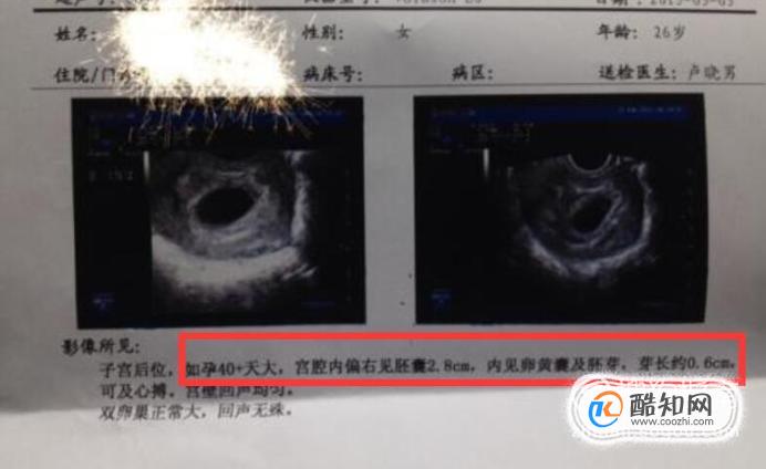 懷孕的時(shí)候能養(yǎng)狗嗎_狗懷孕能喂雞架嗎_狗和小孩能一起養(yǎng)嗎